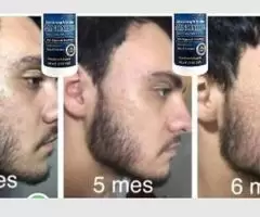 Como Crecer La Barba y Cabello Producto De Belleza Nuevo