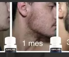 Como Crecer La Barba y Cabello Producto De Belleza Nuevo